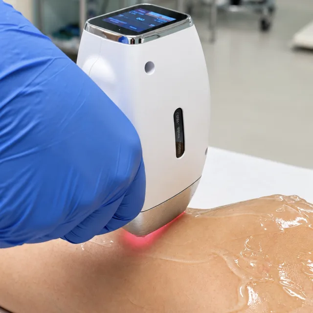 Laser-Hautbehandlung